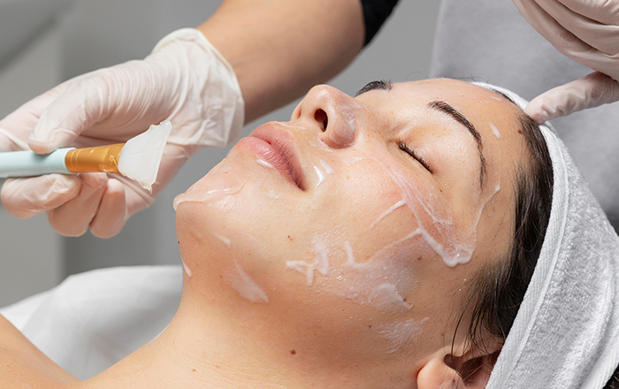 Peeling Enzimático