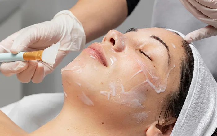 Peeling Enzimático